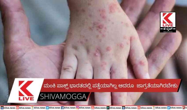 ಮಂಕಿ ಪಾಕ್ಸ್ ಭಾರತದಲ್ಲಿ ಪತ್ತೆಯಾಗಿಲ್ಲ ಆದರೂ ಜಾಗ್ರತೆಯಾಗಿರಬೇಕು