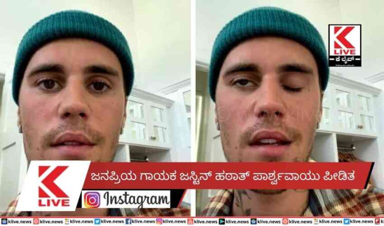 ಜನಪ್ರಿಯ ಗಾಯಕ ಜಸ್ಟಿನ್ ಹಠಾತ್ ಪಾರ್ಶ್ವವಾಯು ಪೀಡಿತ