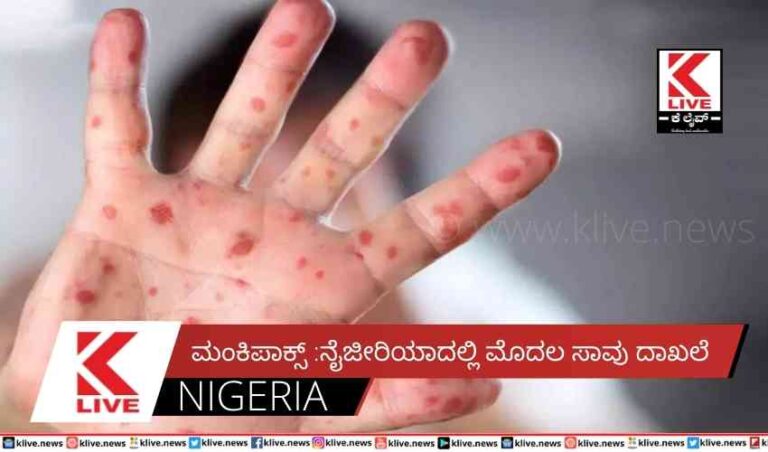 ಮಂಕಿಪಾಕ್ಸ್ :ನೈಜೀರಿಯಾದಲ್ಲಿ ಮೊದಲ ಸಾವು ದಾಖಲೆ