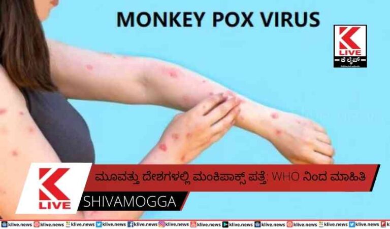 ಮೂವತ್ತು ದೇಶಗಳಲ್ಲಿ ಮಂಕಿಪಾಕ್ಸ್ ಪತ್ತೆ: WHO ನಿಂದ ಮಾಹಿತಿ