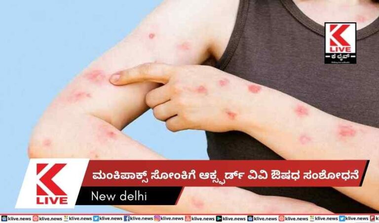 ಮಂಕಿಪಾಕ್ಸ್ ಸೋಂಕಿಗೆ ಆಕ್ಸ್ಫರ್ಡ್ ವಿವಿ ಔಷಧ ಸಂಶೋಧನೆ