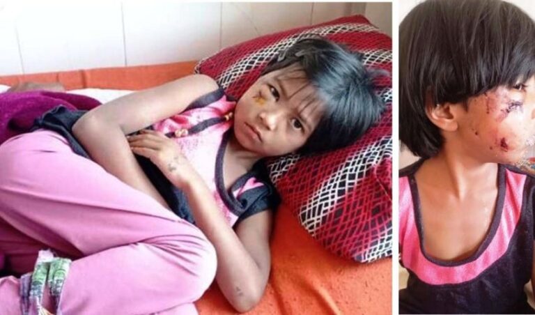 ಚಿಕ್ಕಮಗಳೂರಿನಲ್ಲಿ ಬೀದಿನಾಯಿ ನಿಯಂತ್ರಣಕ್ಕೆ ಜೆಡಿಎಸ್ ನಗರ ಸಭಾಸದಸ್ಯರ ಒತ್ತಾಯ